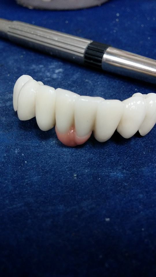 TEHNICIAN DENTAR ESTETICA