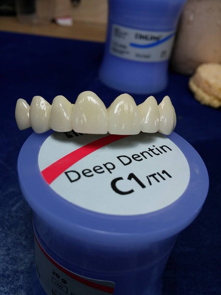 TEHNICIAN DENTAR ESTETICA