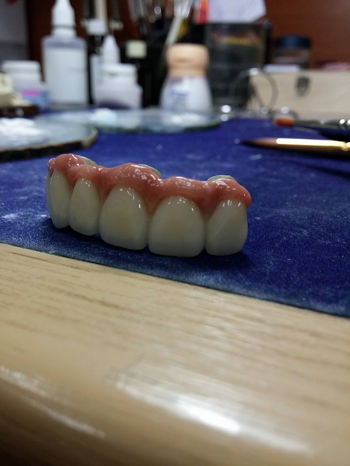 TEHNICIAN DENTAR ESTETICA
